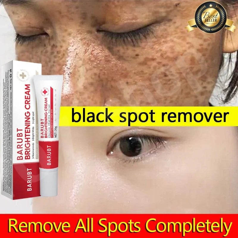 🎁 Buy 1 Get 1 FREE Chalonese Brightening Cream Dark Spots & Skin Brightening Cream