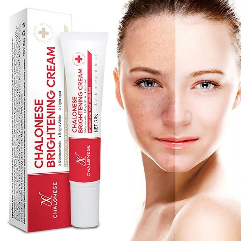 🎁 Buy 1 Get 1 FREE Chalonese Brightening Cream Dark Spots & Skin Brightening Cream
