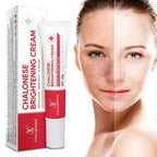🎁 Buy 1 Get 1 FREE Chalonese Brightening Cream Dark Spots & Skin Brightening Cream