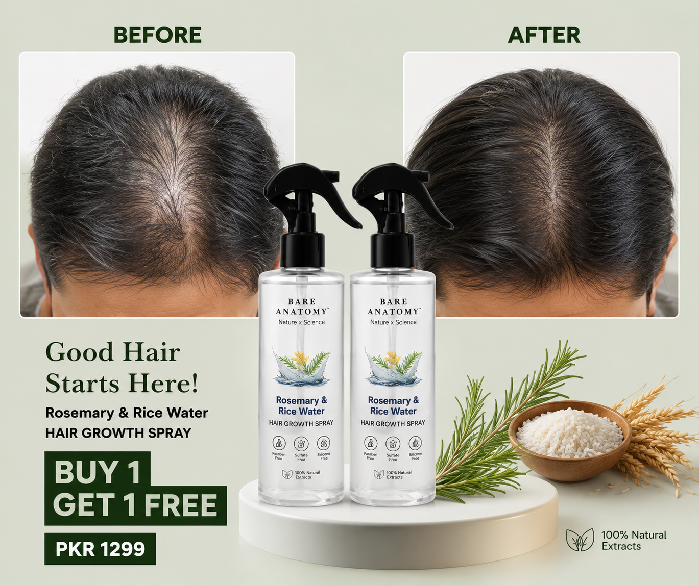 Bundle Rice Water Hair Growth Spray Hair Fall Control & Hair Growth Solution For Men & Women