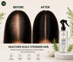Bundle Rice Water Hair Growth Spray Hair Fall Control & Hair Growth Solution For Men & Women