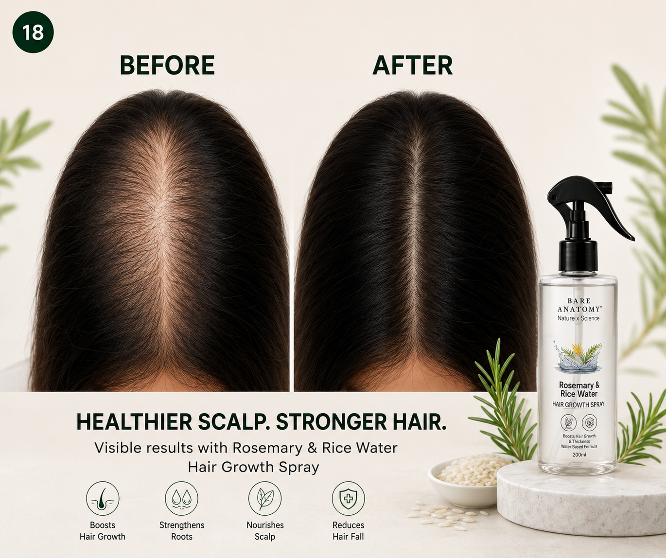 Bundle Rice Water Hair Growth Spray Hair Fall Control & Hair Growth Solution For Men & Women