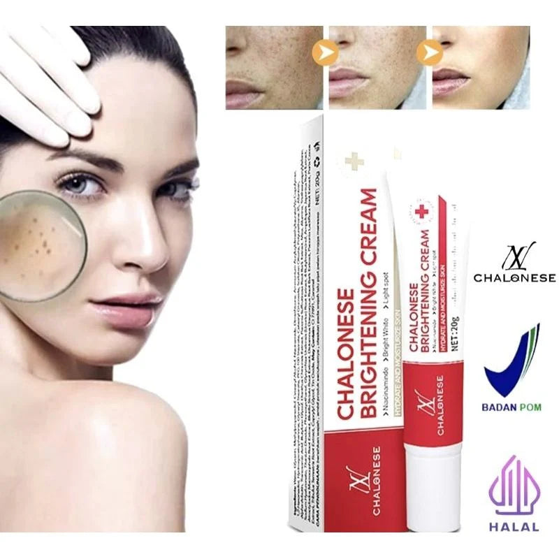 🎁 Buy 1 Get 1 FREE Chalonese Brightening Cream Dark Spots & Skin Brightening Cream