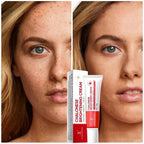 🎁 Buy 1 Get 1 FREE Chalonese Brightening Cream Dark Spots & Skin Brightening Cream